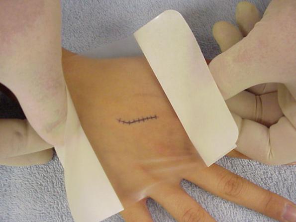 سایت خرید پانسمان های جدید آماده